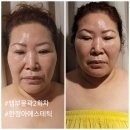 한정아 에스테틱 이미지