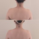 봄에스테틱 | [배곧 봄에스테틱] 3V 윤곽관리 후기 시흥피부관리 배곧웨딩관리