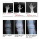 바른정형외과의원 이미지