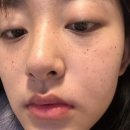 장희빈