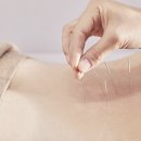 아이재한의원 이미지