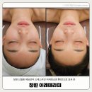성산구 ⓒ-31 | 창원웨딩관리 이레테라피 말린어깨 비대칭 작은얼굴 맞춤 신부관리