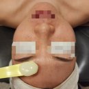 캔디피부관리실 네이버블로그