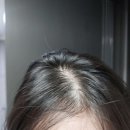 (주)현대약품 | 얇은 머리카락 머리카락 빠짐이 고민이라면 현대약품 마이녹셀 스칼프 인텐시브 앰플 후기