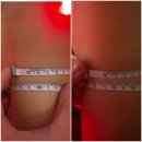 상동 피부관리 1회만에 팔뚝 2cm 감량 | 더헤르츠스킨 상동본점 승모근케어 후기