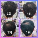 작전 | [ 계양구 두피관리🧑🏻‍🦲🪮 ] 탈모 고민 큐사랑 작전점 솔직후기