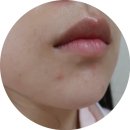 레이저 이미지