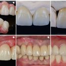 다연치과기공소 이미지