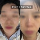 인천 서구 가정동 피부관리 기미 미작뷰티 검단점 잡티제거 후기