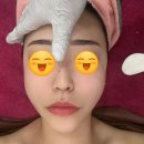 청주피부관리 퀸스킨앤바디 얼굴비대칭, 균형 잡아주는 윤곽술 리얼 후기