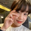 치아교정 일기 08 | 치아교정 6개월 전후 사진비교 &#34;앞니가 많이 움직였네&#34;