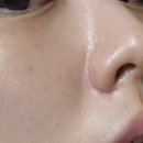 리더스 랩 | [일산:알엔스킨뷰티랩] 필링 후 수분재생관리