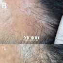 50대 홈케어 병행 MO100 후기