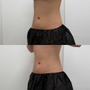파발로 | 경기광주바디관리 ! 뉴로클래식 바디슬리밍으로 체형관리 겸 복부관리 다녀온 후기