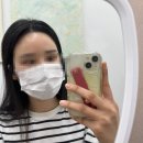 뷰티뷰 | 대전헤어라인 뷰티뷰 헤어라인 시술 후기