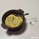 하이웰치과의원 | 매복 사랑니 발치 후기 (동탄 하이웰치과의원)