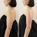 마곡에스테틱 스킨에픽 | 슬리밍 테라노바 관리 솔직후기