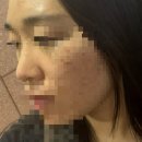 강남 코실리프팅 잘하는 곳? 세로코 한의원 방문 후기