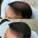 보성헤어 | 보성반영구창업 처음부터 끝까지 리얼 경험 공유합니다