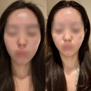 청계산입구역 1번출구 뒤 | 강남 서초동 에스테틱 피부관리샵 메이에르 내돈내산 추천 후기