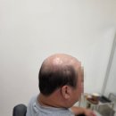 위드위 | 안산맞춤가발 자연스럽게 만족한 위드위그 방문 후기