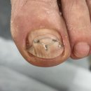 패디히얼