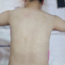 광혜원면사무소 건강관리실 | 익산 영등동 &#34; 익산테라피온유 &#34; 에너지 테라피 등 관리 사독테라피 후기