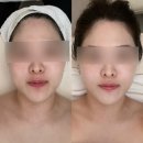 지에스25 익산라인점 | 벨레브에스테틱_ 익산 윤곽관리 잘하는 곳