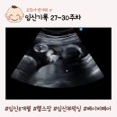 속눈썹바람이분다 | [임신27-30주차] 임신8개월 증상, 배크기, 임산부헬스장, 왁싱, 베이비페어, 30주초음파