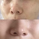 내돈내산) 서충주 연세메디컬 피부과 찐후기! 출산 후 잡티 &amp; 피부톤 고민, 여기서 졸업했어요! ✨