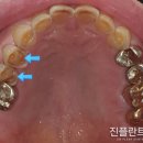 상아플란트치과 이미지