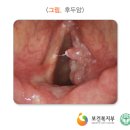 쉼 이미지