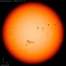 태양반점 이미지