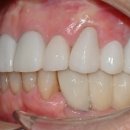 정원치과기공소 이미지