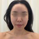 청담스킨앤바디 | 풍무동피부관리 추천🩵 청담스킨앤바디 물방울 관리 받고 온 후기💧