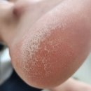 네일이야기 | 양재발각질 네일은풋케어 다녀온 후기 발뒤꿈치 관리 이야기