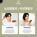 🧴 정수리 탈모 치료, 뉴보자르에서 새롭게 시작했어요
