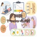 골다공증 T-score -2.5란? 검사 결과 쉽게 이해하기 이미지
