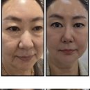 인셀덤블랙