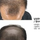 콤마더문 이미지