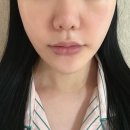 쥬코스메틱 | 스킨부스터 시술후크림 추천 PDRN크림 리리쥬 리페어크림 후기