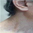 행복한용지약국 | 개선을 위한 마이크로바이옴샴푸 여청 카밍엑스 미라클아토에이씨포어쎄럼 극윤 더모베이트액 사용후기