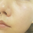 아미가에스테틱(강남) | 강남구청역피부관리 아미가에스테틱 작은얼굴윤곽관리 후기