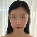 아프로뷰티 | 여배우 윤곽관리 잘하는 논현역 뷰티다룸 강남 본점 비포에프터 후기
