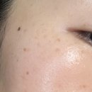 애프터아워스 | 브라이트닝 집중 관리 : 숨37 타임 에너지 브라이트 스팟 코렉팅 컨센트레이트 비포 애프터 3주 사용 후기