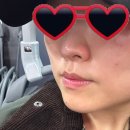 울산 신부관리 추천 세라에스테틱 5회차 후기