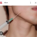 화수한의원 | 더마톡신 스킨보톡스 더모톡신 부작용 치료 눈가 이마 입가 광후기 좋은 시술 훨씬 빨리 좋아져요