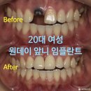 서울유플란트치과의원 이미지