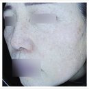 김민규내과의원 | 지족동피부과 기미제거, 현직 의사의 충고