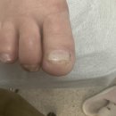 푸스케어 파주운정점(라푼젤네일) | [파주 네일] 라푼젤 네일 푸스 케어 파주 운정점